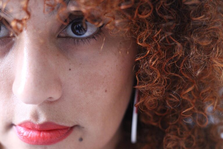 얼굴 기미 제거: 효과적이고 안전한 방법으로 자신감 되찾기